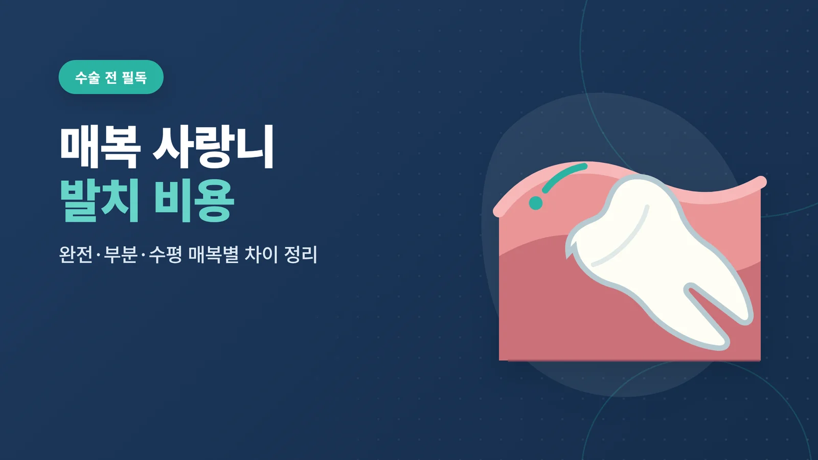 매복 사랑니 발치 비용